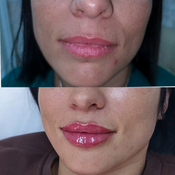 Ирина Булгар, Одесса Фото - 59