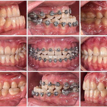 Олег Теперев, Киев Фото - 5