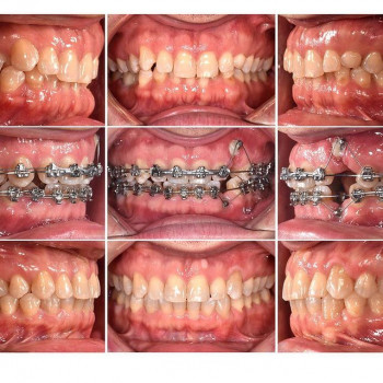 Олег Теперев, Киев Фото - 6