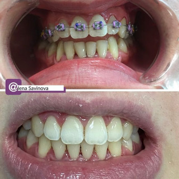 Алёна Савинова, Киев Фото - 5