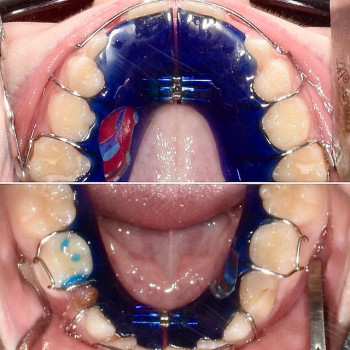 Вікторія Морикон, Киев Фото - 5