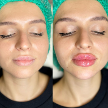 Юлия Микитин, Львів Фото - 5