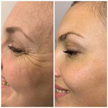 Юлия Микитин, Львів Фото - 11