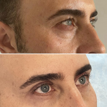 Абдель Эрритали, Харків Фото - 90