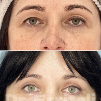 Абдель Эрритали, Харків Фото - 11