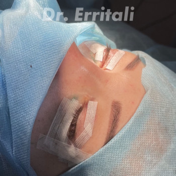 Абдель Эрритали, Харків Фото - 79