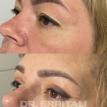 Абдель Эрритали, Харків Фото - 92