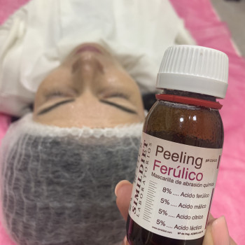 Феруловий пілінг