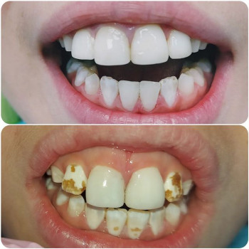 Карина Галиновская, Полтава Фото - 5