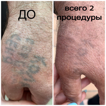 Людмила Чернеховская, Одесса Фото - 25