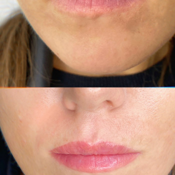 Перманентный макияж губ / Акварельные губы / Помадные губы / Татуаж
                    Мастер перманентного макияжа Алина Киев