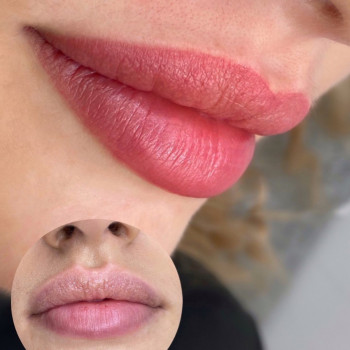 Аліна Туяхова, Київ Фото - 1