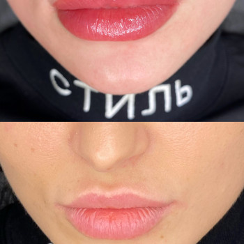 Аліна Туяхова, Київ Фото - 39