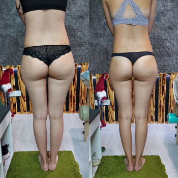 Ирина Чайковская, Одесса Фото - 7