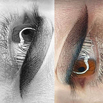 Сразу после процедуры