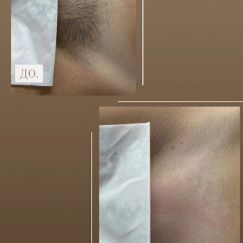 Диана Тесленко, Біла Церква Фото - 2