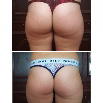 SPA-ПРОЦЕДУРА «Звезда», ГИПОСТЕРАПИЯ, Bruno Vassari\Бруно Вассари
                    Масажист Алеся Київ