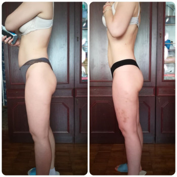 SPA-ПРОЦЕДУРА «Звезда», ГИПОСТЕРАПИЯ, Bruno Vassari\Бруно Вассари
                    Масажист Алеся Київ