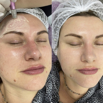 Фото из портфолио мастера Екатерина Клюкина (мастер перманентного макияжа, Киев)