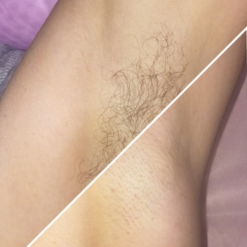 Виктория Шугаринг, Харьков Фото - 5