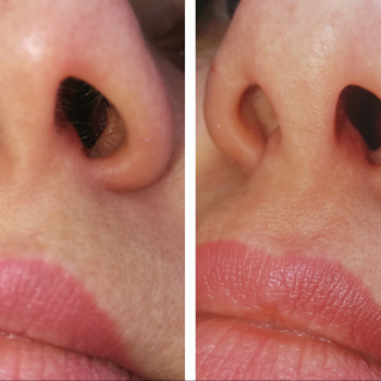 Виктория Шугаринг, Харьков Фото - 6