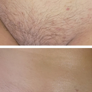 Виктория Шугаринг, Харьков Фото - 7