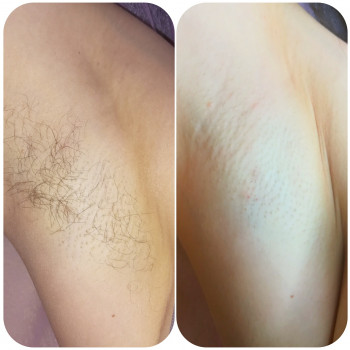 Виктория Шугаринг, Харьков Фото - 8