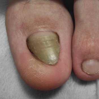 Оксана Линкевич, Мариуполь Фото - 11