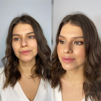 Инна Надольская, Черновцы Фото - 7