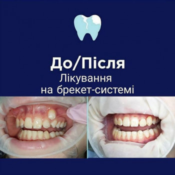 Вита Барабаш, Кременчуг Фото - 5