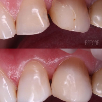 Олег Сова, Івано-Франківськ Фото - 5