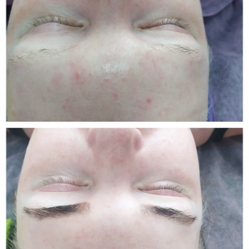 Уход shine stop, для жирной, комбинированной кожи и кожи с акне
                    Косметолог-естетист Ирина Київ