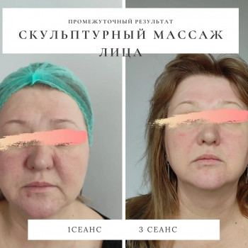 Скульптурный массаж лица