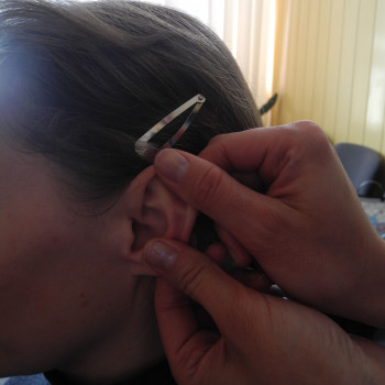 Аурикулярный массаж.
20 мин. - 200 грн.