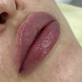 Наталія Кравчук, Ровно Фото - 5