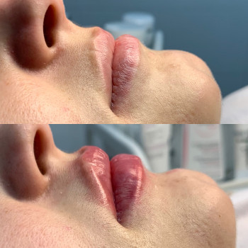 Наталія Кравчук, Ровно Фото - 6