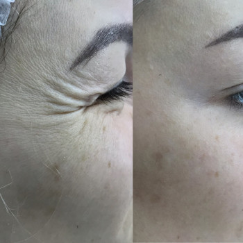 Наталія Кравчук, Ровно Фото - 7