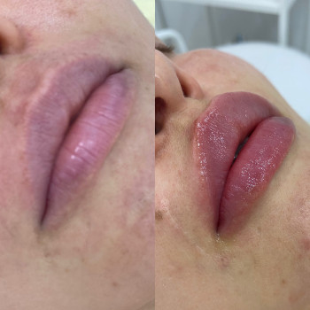 Наталія Кравчук, Ровно Фото - 8