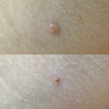 Наталія Кравчук, Ровно Фото - 9