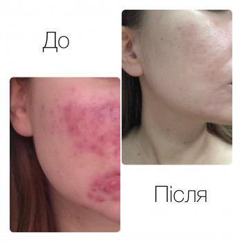 Наталія Кравчук, Ровно Фото - 11