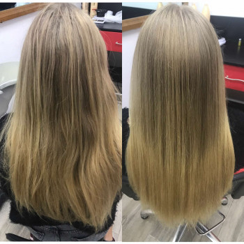 Холодный ботокс