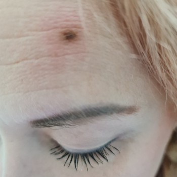 Видалення новоутворень
                    Косметолог Мария Киев