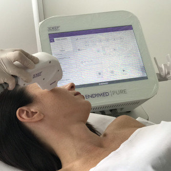 Сучасне фракційне шліфування обличчя та тіла.