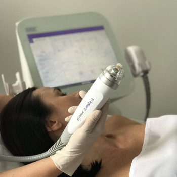 Найпотужніше фракційне омолодження на апараті EndyMed.