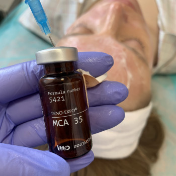 Пилинг
                    Косметолог-инъекционист Алла Харьков