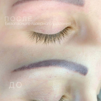 Павло Лазер, Киев Фото - 3