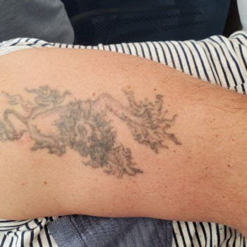 Павло Лазер, Киев Фото - 5