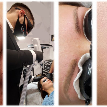 Павло Лазер, Киев Фото - 7