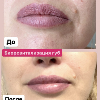 Наталія Бутенко, Полтава Фото - 56