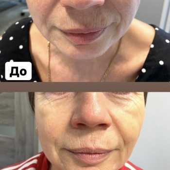 Наталія Бутенко, Полтава Фото - 58